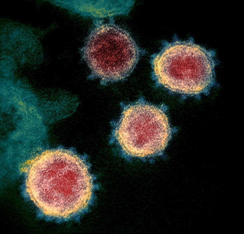 This transmission electron microscope image shows SARS-CoV-2—also known as 2019-nCoV, the virus that causes COVID-19—isolated from a patient in the U.S. Virus particles are shown emerging from the surface of cells cultured in the lab. The spikes on the outer edge of the virus particles give coronaviruses their name, crown-like.